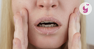 Co na suché a popraskané rty? Příčiny a 7 účinných tipů