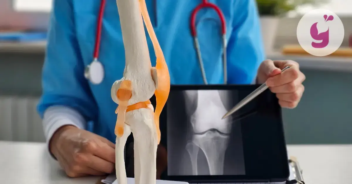 Viete čo je dobré na kosti, kĺby a šľachy? Najlepšie potraviny a vitamíny