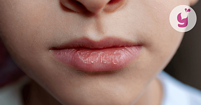 Suché a popraskané pery u detí: príčiny a čo môže pomôcť