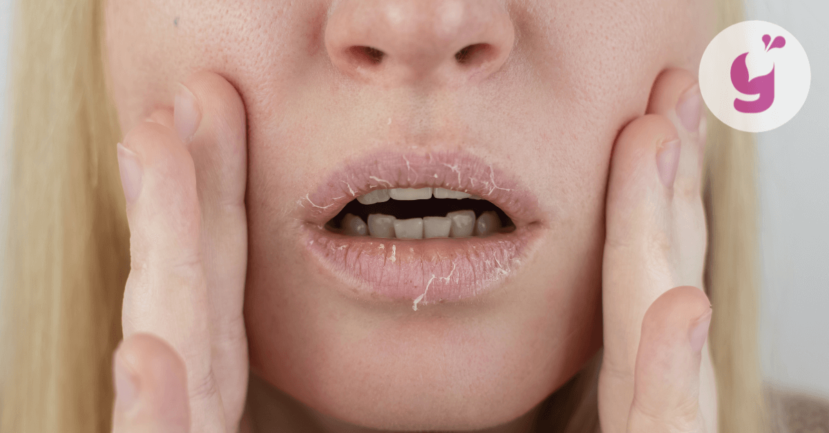 Suché a popraskané pery (aj extrémne): príčiny, ako im predchádzať a ako sa ich rýchlo zbaviť